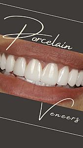 Smile Essentials