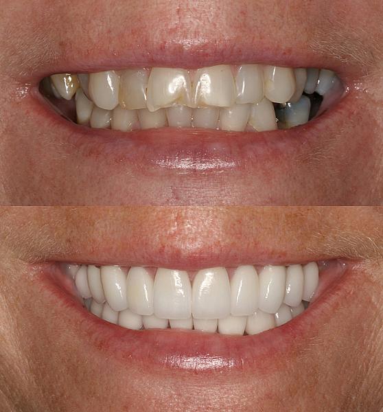 Burbank Dental Lab